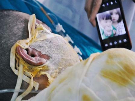 Vụ 2 cô gái bị thiêu sống ở Vĩnh Phúc: Nằm trên giường bệnh, người mẹ đau đớn nhìn con qua màn hình điện thoại cho vơi nỗi nhớ
