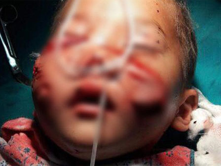 Đến bác sĩ thú y cũng chết vì bệnh dại: VN bị coi là điểm nóng toàn cầu bởi con số đáng sợ-3