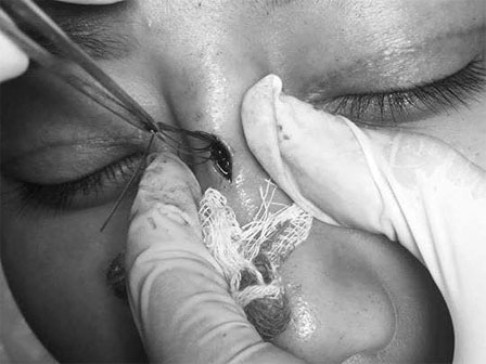 Dù mũi chẳng cao và thon nhưng loạt Sao vẫn nhất quyết không đụng chạm dao kéo!-15