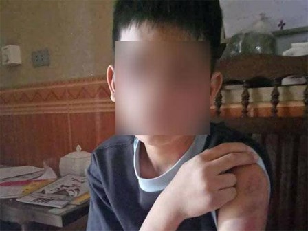 Bé trai 14 tuổi bị bố và mẹ kế đánh đập: Mẹ ruột sốc, không nhận ra con khi gặp