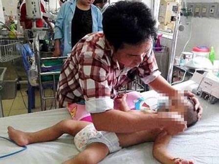 Kinh hoàng cháu bé gần 2 tuổi bị hàng nghìn vết ong đốt
