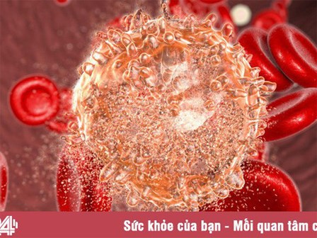 Ung thư máu sống được bao lâu?