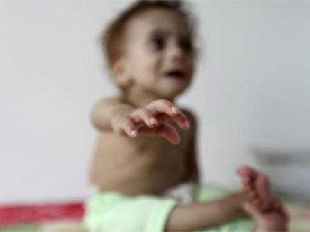 Bé gái 14 tuổi tử vong vì suy dinh dưỡng nghiêm trọng, cảnh sát phát hiện âm mưu tàn ác của người mẹ cố tình đẩy con vào chỗ chết-7