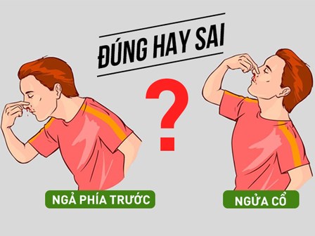 Ngả phía trước hay ngửa đầu ra sau khi chảy máu cam: Không biết khiến bạn có thể xử lý sai