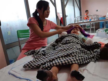 Mẹ bé gái tay chân hoại tử sau cơn sốt ban đêm: Thế là con mất hết tay, chân rồi”-1