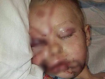 Bị tấn công khi đang bắt taxi, cô gái bình tĩnh đi báo công an với con dao cắm giữa mặt-5