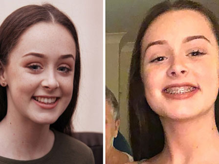 Cách trị mụn nhọt mùa hè đơn giản nhưng hiệu quả không tưởng”-3