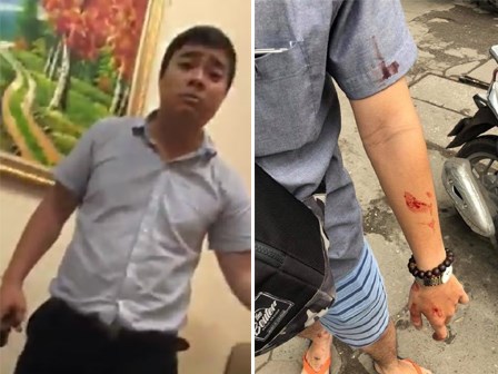 Hà Nội: Giám đốc đánh nữ sinh viên nhập viện vì đến đòi lại tiền cọc sau một tháng không được nhận lớp gia sư
