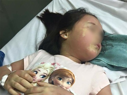 Thực hư vụ bé gái 5 tuổi phải nhập viện Bạch Mai khẩn cấp nghi do ngộ độc trà sữa