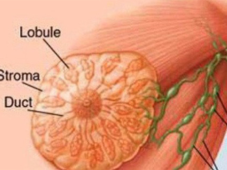 Bác sĩ choáng với khối u nặng 45 kg trên người nam thanh niên-4