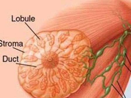 Bác sĩ BV K khuyến cáo: Phát hiện trên ngực có khối u này, chị em nên bình tĩnh xử trí