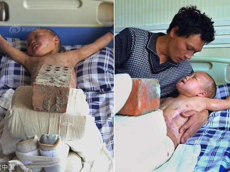 Xót xa chuyện người đàn ông bị vợ bỏ rơi, mỗi ngày dùng 15kg gạch đè lên chân đứa con 5 tuổi để chữa bỏng