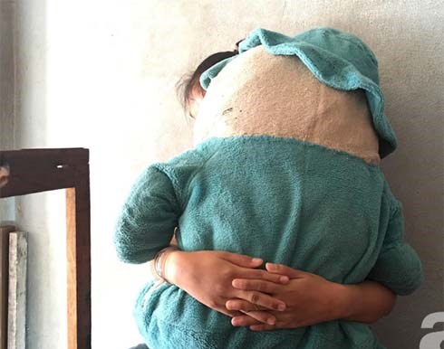 Vụ bé gái 11 tuổi câm điếc bị xe ôm hiếp dâm: Tìm thấy ADN nghi phạm trong vùng kín của bé gái