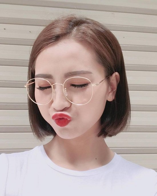 Hình ảnh diễn viên Việt Anh bị đánh thâm tím mặt mày gây chú ý-11