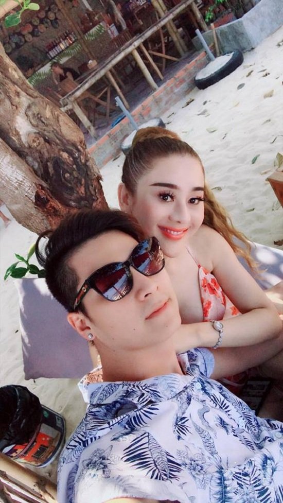 Hình ảnh diễn viên Việt Anh bị đánh thâm tím mặt mày gây chú ý-4