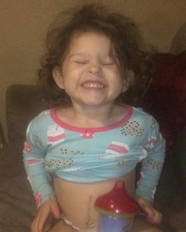 Mẹ sốc khi thấy con gái 2 tuổi dậy thì sớm nhưng không ngờ điều đó lại cứu mạng con-2