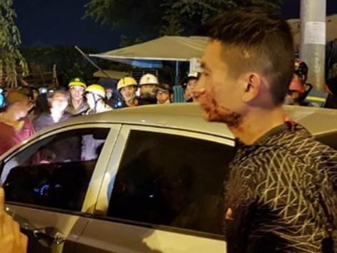 Đôi vợ chồng đi xe máy bị tài xế ô tô đánh be bét máu giữa đường xin… giảng hòa