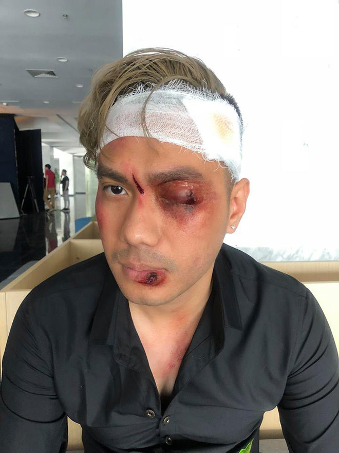 Người phán xử phần 2: Sợ hãi trước cảnh mù mắt của Thế Chột thời trẻ-2