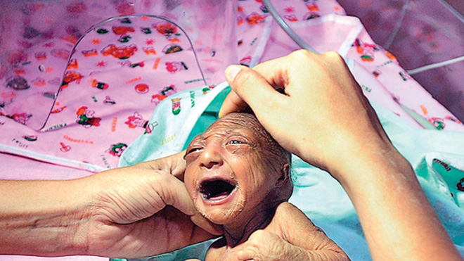 Bố mẹ nhẫn tâm bỏ đói đến chết con gái 2 tuần tuổi vì con có ngoại hình khác thường, may mắn thay vị cứu tinh đã xuất hiện-2