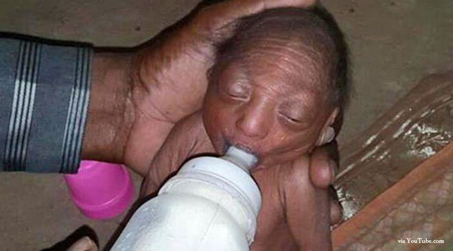 Bố mẹ nhẫn tâm bỏ đói đến chết con gái 2 tuần tuổi vì con có ngoại hình khác thường, may mắn thay vị cứu tinh đã xuất hiện-3