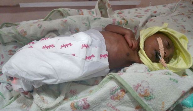 Bố mẹ nhẫn tâm bỏ đói đến chết con gái 2 tuần tuổi vì con có ngoại hình khác thường, may mắn thay vị cứu tinh đã xuất hiện-4