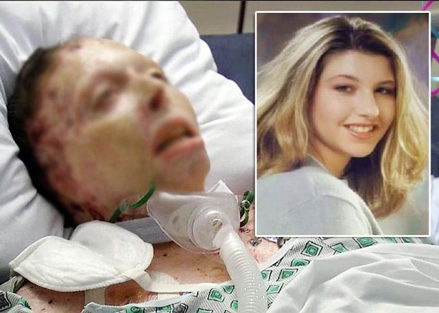 Bằng chứng bất ngờ của cô gái dù đã chết vì bị thiêu sống vẫn khiến hung thủ vào tù-1