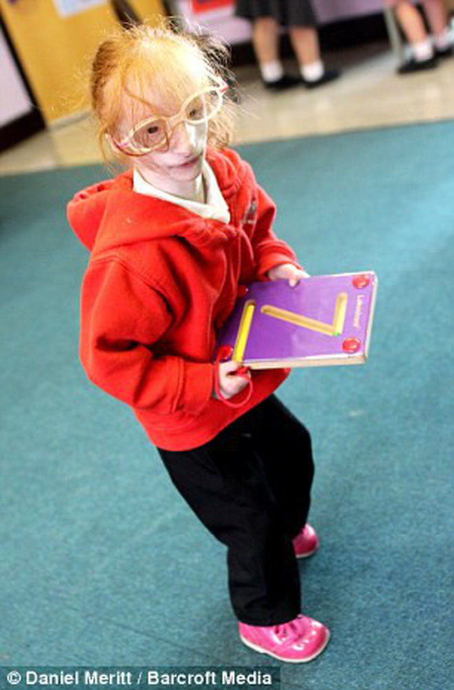 Cuộc đời của cô bé nhỏ nhất thế giới: Bác sĩ nói rằng em chỉ sống được 1 năm, nhưng nghị lực sống đã chiến thắng tất cả-7