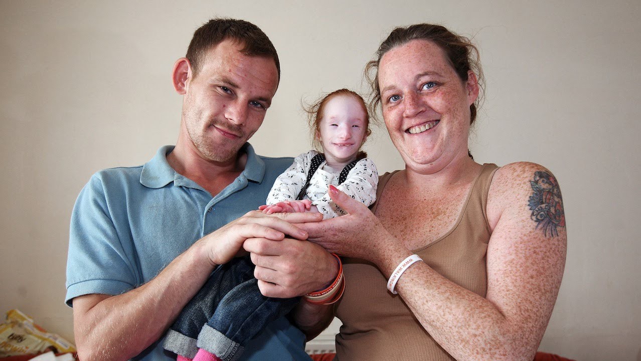 Cuộc đời của cô bé nhỏ nhất thế giới: Bác sĩ nói rằng em chỉ sống được 1 năm, nhưng nghị lực sống đã chiến thắng tất cả-8