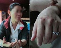 Tâm sự của người phụ nữ xuất khẩu lao động: Thoát khỏi "địa ngục trần gian" Tâm sự của người phụ nữ xuất khẩu lao động: Thoát khỏi "địa ngục trần gian"