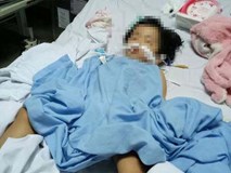 Bé 20 tháng tuổi rạn hộp sọ, hôn mê sâu, liệt nửa người sau 3 ngày đến trường mầm non Bé 20 tháng tuổi rạn hộp sọ, hôn mê sâu, liệt nửa người sau 3 ngày đến trường mầm non