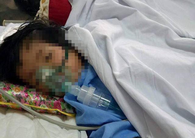 Bé 20 tháng tuổi rạn hộp sọ, hôn mê sâu, liệt nửa người sau 3 ngày đến trường mầm non-1