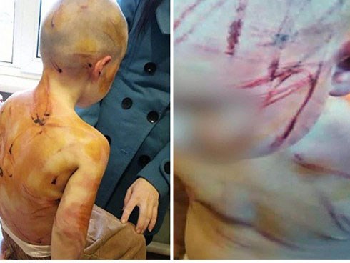 Mẹ dửng dưng đứng nhìn bạn trai đánh đập con gái dã man vì lý do không ngờ