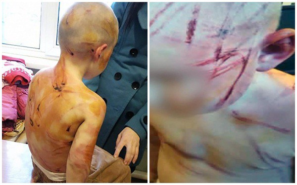 Mẹ dửng dưng đứng nhìn bạn trai đánh đập con gái dã man vì lý do không ngờ-1