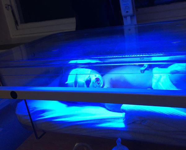 Sử dụng giác hút hỗ trợ khi đẻ thường, mẹ đau đớn nhìn con mang sẹo cả đời-4