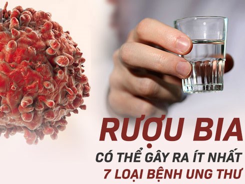 Không chỉ tự làm tổn thương gan, người hay uống bia rượu có nguy cơ mắc 7 loại ung thư