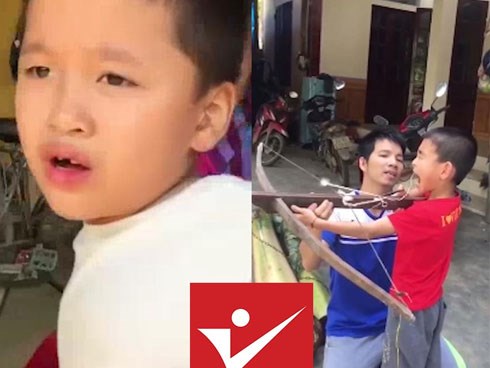 Những màn nhổ răng cho con siêu bá đạo của các ông bố Việt