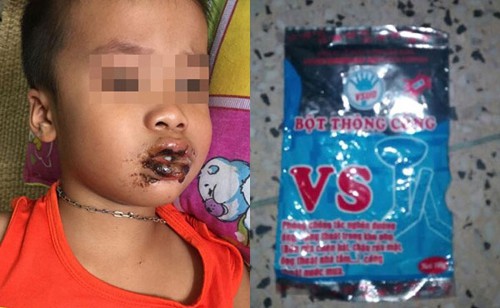 Bé trai 1 tuổi ăn nhầm bột thông bồn cầu-1