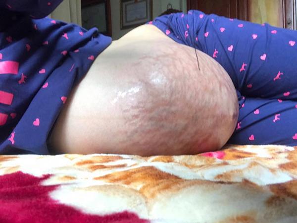 Hình ảnh bụng bầu như sắp rơi khiến chị em chẳng còn muốn đẻ đôi một lần cho xong-4