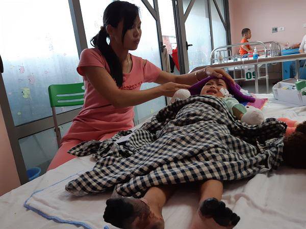 Mẹ bé gái tay chân hoại tử sau cơn sốt ban đêm: Thế là con mất hết tay, chân rồi”-2