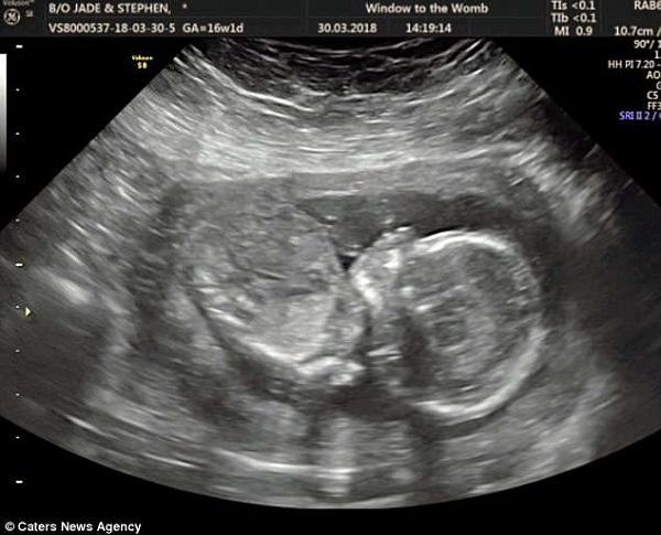 Mẹ bầu phát hoảng” khi phát hiện hình ảnh siêu âm con trong bụng giống hệt… hình cậu nhỏ-4