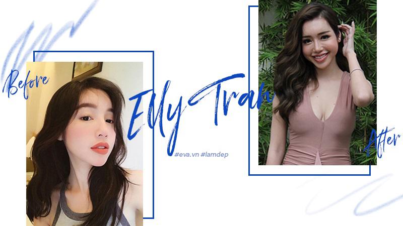 Tiêm filler xóa nhăn, độn cằm, tạo dáng mặt... đang dần trở thành cơn sốt oanh tạc showbiz-4