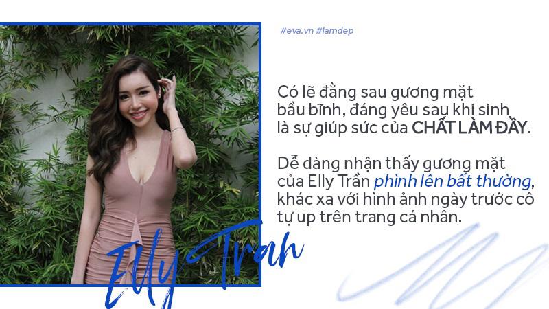 Tiêm filler xóa nhăn, độn cằm, tạo dáng mặt... đang dần trở thành cơn sốt oanh tạc showbiz-5