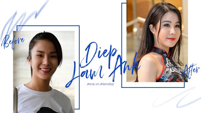 Tiêm filler xóa nhăn, độn cằm, tạo dáng mặt... đang dần trở thành cơn sốt oanh tạc showbiz-6