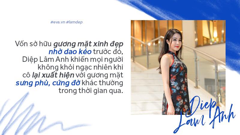 Tiêm filler xóa nhăn, độn cằm, tạo dáng mặt... đang dần trở thành cơn sốt oanh tạc showbiz-7