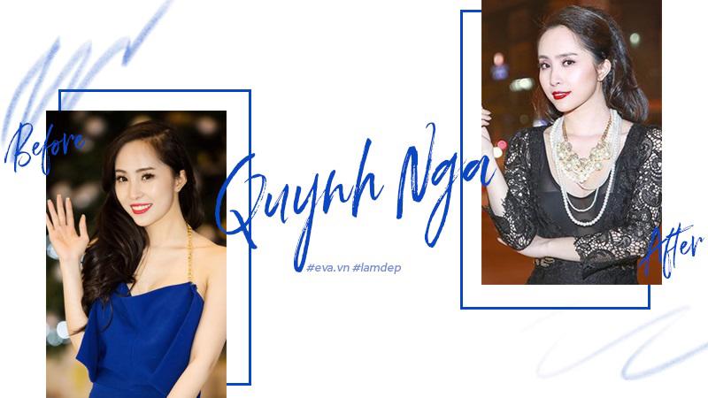 Tiêm filler xóa nhăn, độn cằm, tạo dáng mặt... đang dần trở thành cơn sốt oanh tạc showbiz-10