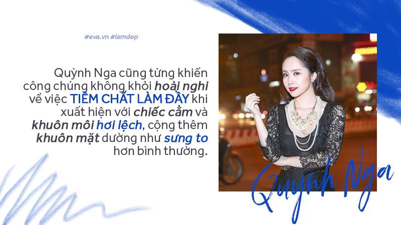 Tiêm filler xóa nhăn, độn cằm, tạo dáng mặt... đang dần trở thành cơn sốt oanh tạc showbiz-11