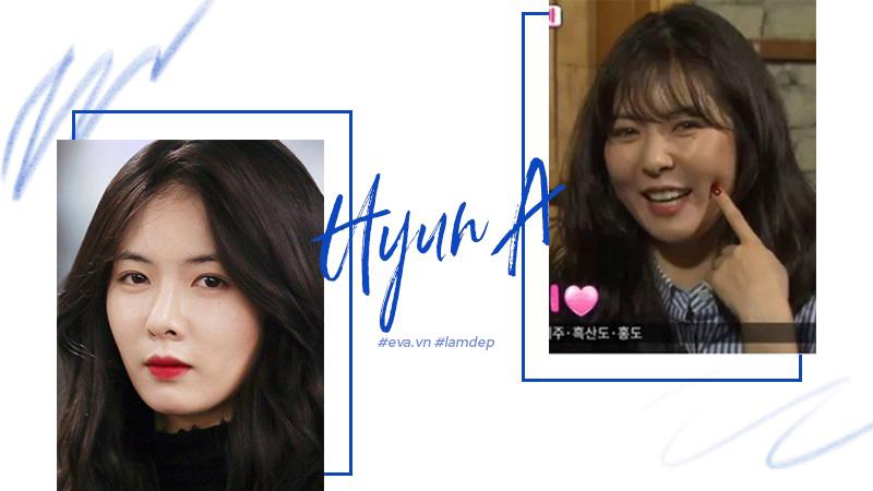 Tiêm filler xóa nhăn, độn cằm, tạo dáng mặt... đang dần trở thành cơn sốt oanh tạc showbiz-12