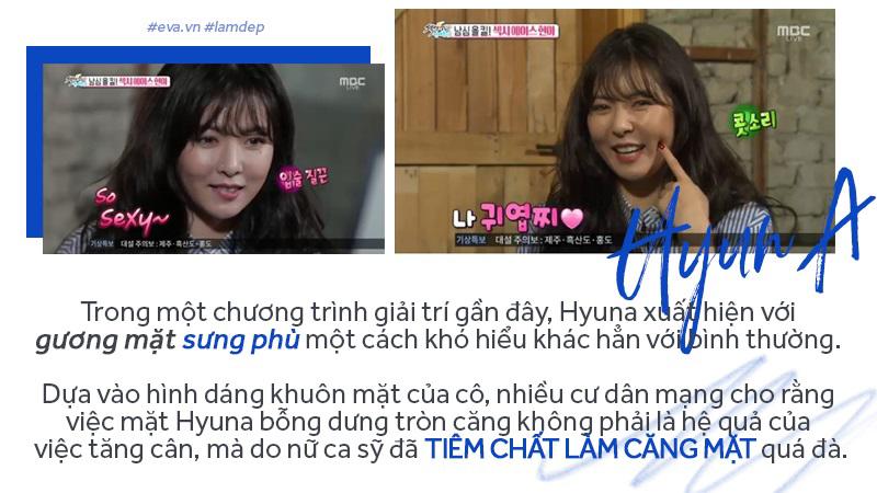 Tiêm filler xóa nhăn, độn cằm, tạo dáng mặt... đang dần trở thành cơn sốt oanh tạc showbiz-13