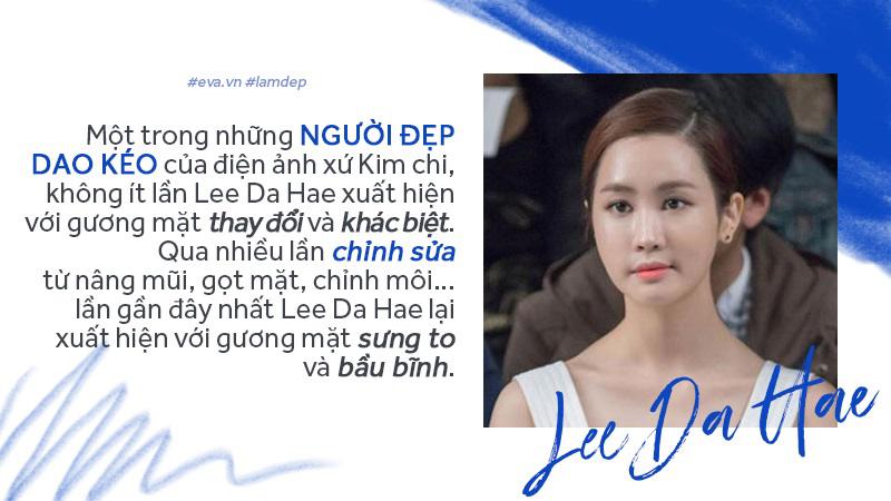Tiêm filler xóa nhăn, độn cằm, tạo dáng mặt... đang dần trở thành cơn sốt oanh tạc showbiz-15