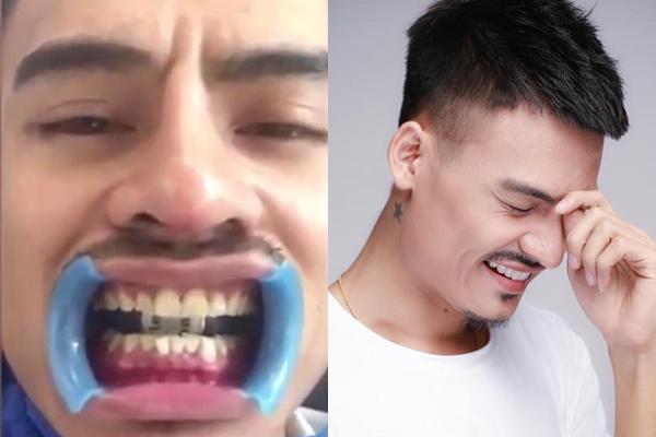 Hết sửa mũi, Hoa Vinh tiếp tục làm răng, xăm lông mày, chuẩn bị tiến vào showbiz?-7